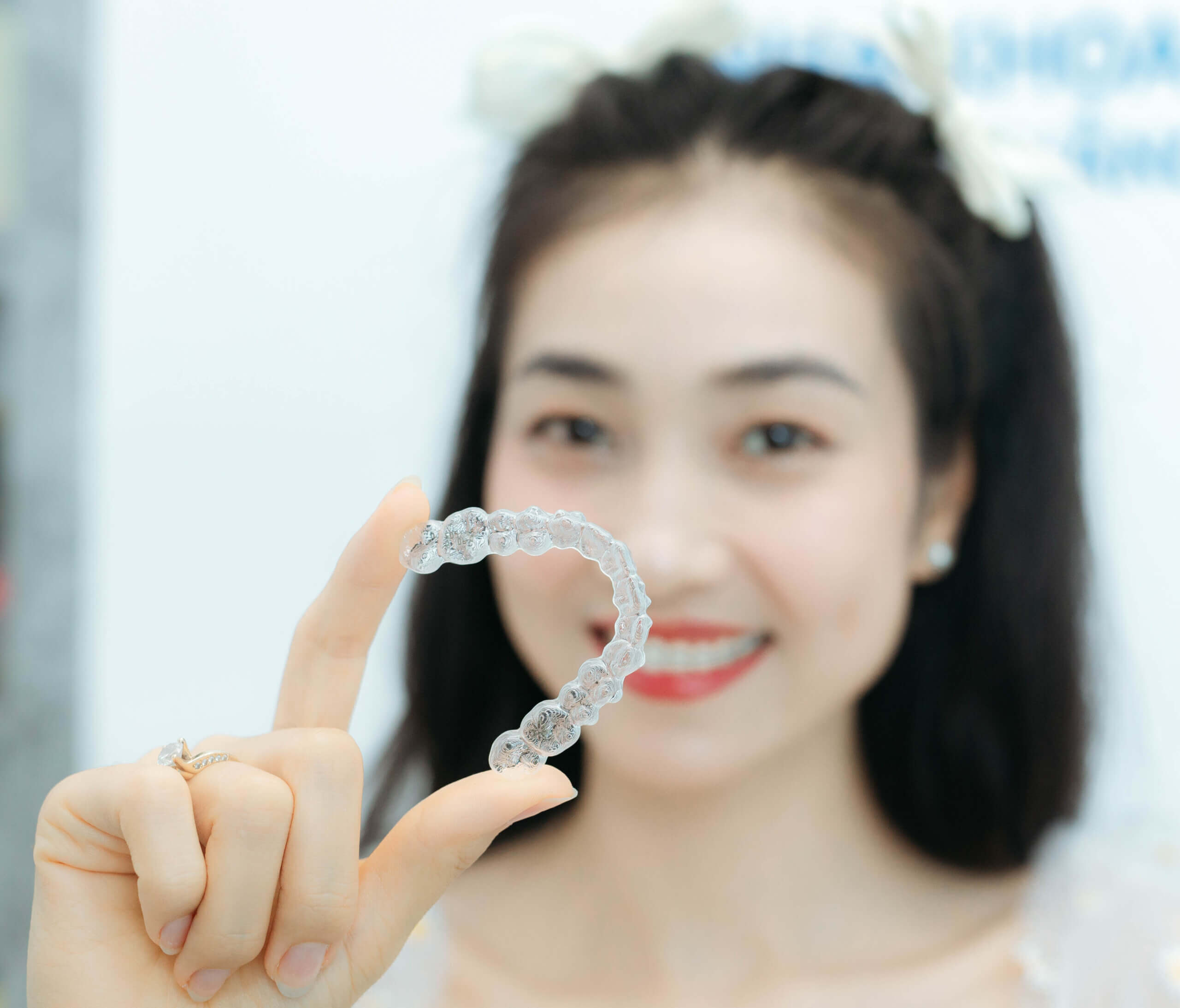 nieng-rang-trong-suot-1 Niềng răng không mắc cài điều trị răng thưa hiệu quả