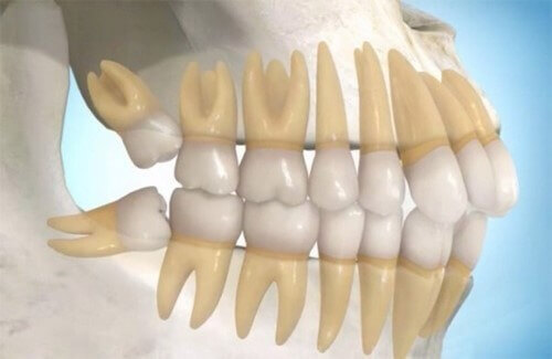 Bệnh nhân cần tái khám sau nhổ răng theo hướng dẫn của nha sĩ