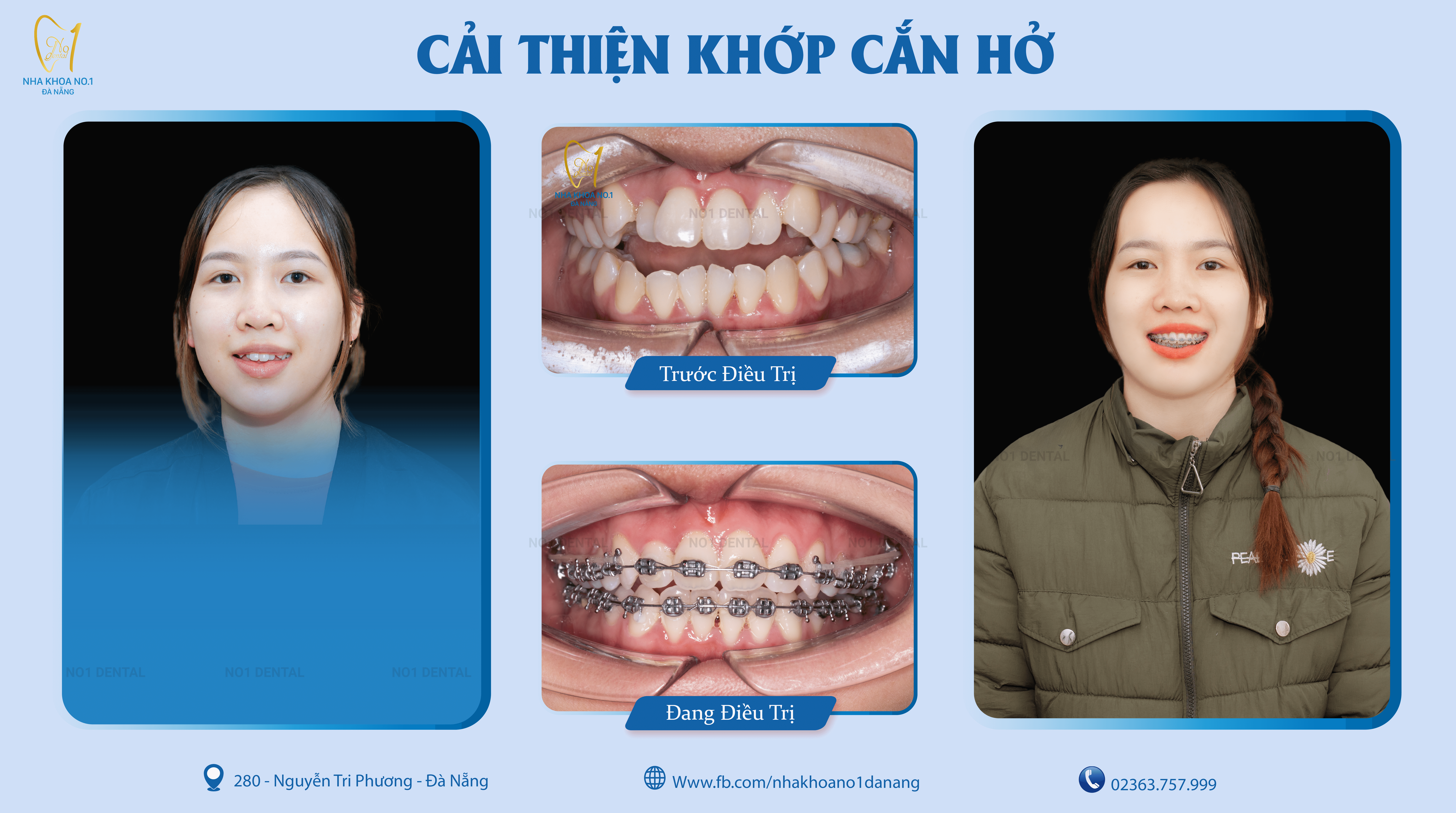 Cơ sở vật chất, máy móc hiện đại hỗ trợ đắc lực cho việc niềng răng