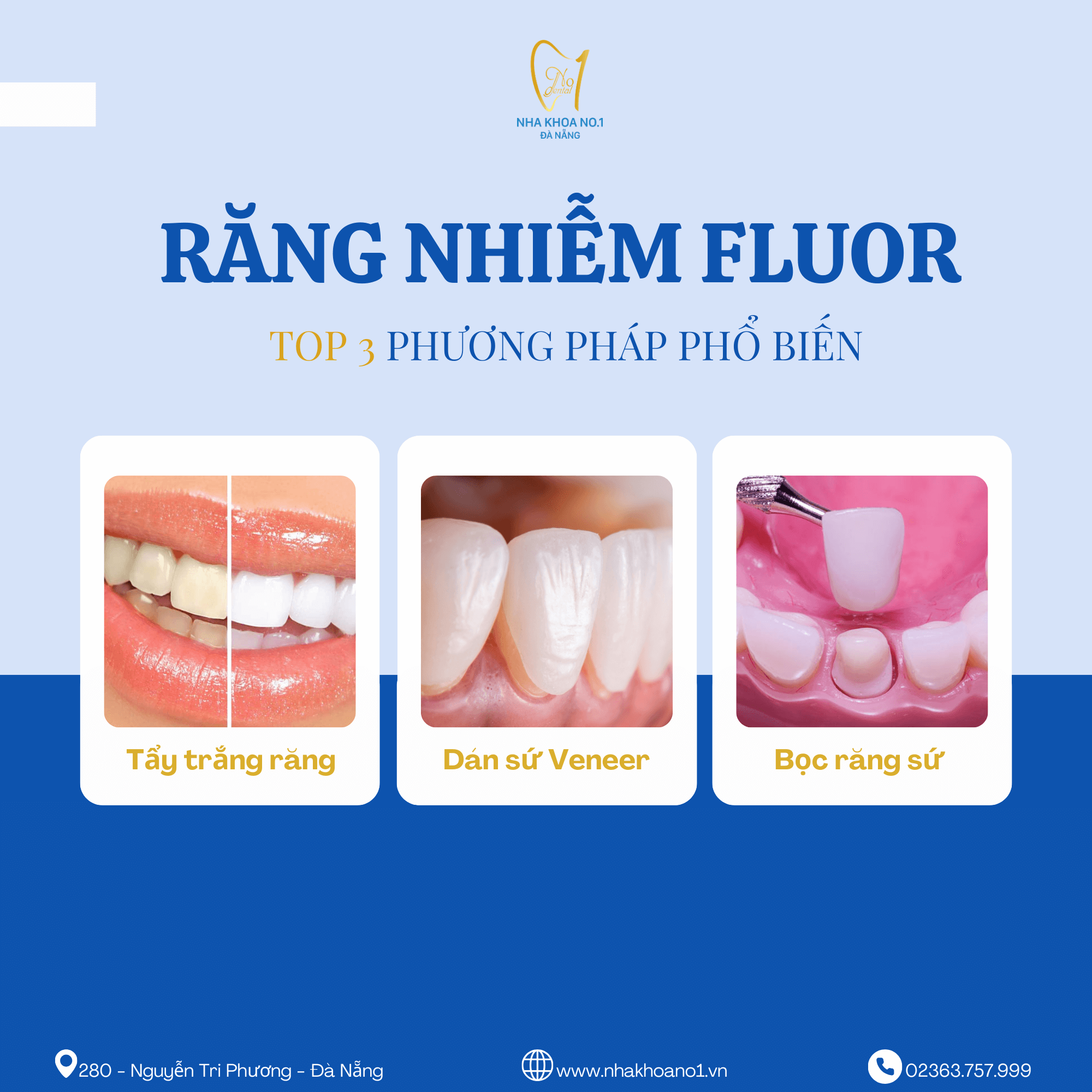 rang-nhiem-fluor-4 rang-nhiem-fluor-4