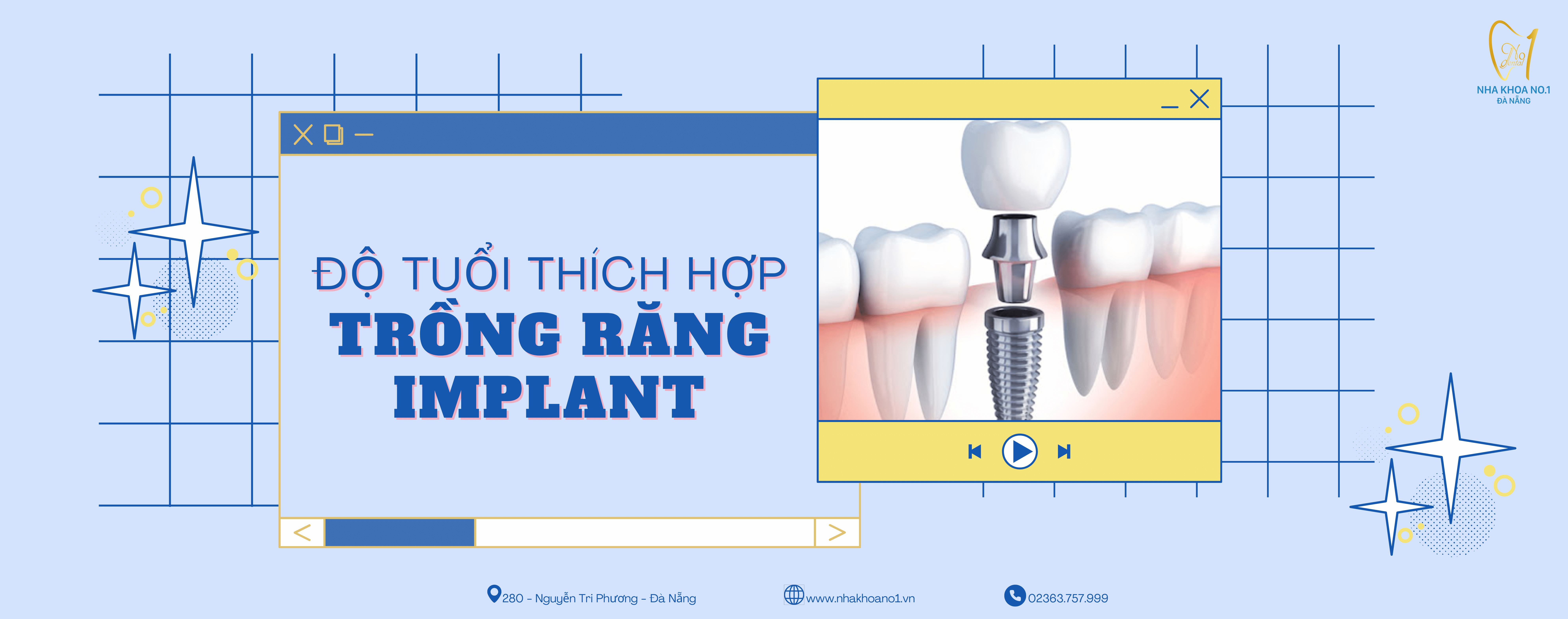Độ tuổi thích hợp để trồng răng Implant
