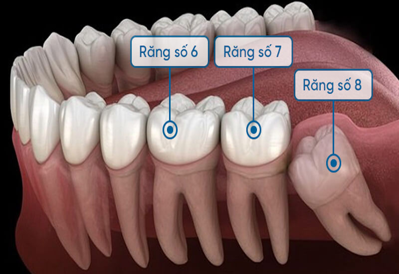 Cách nhận biết răng cấm và răng khôn