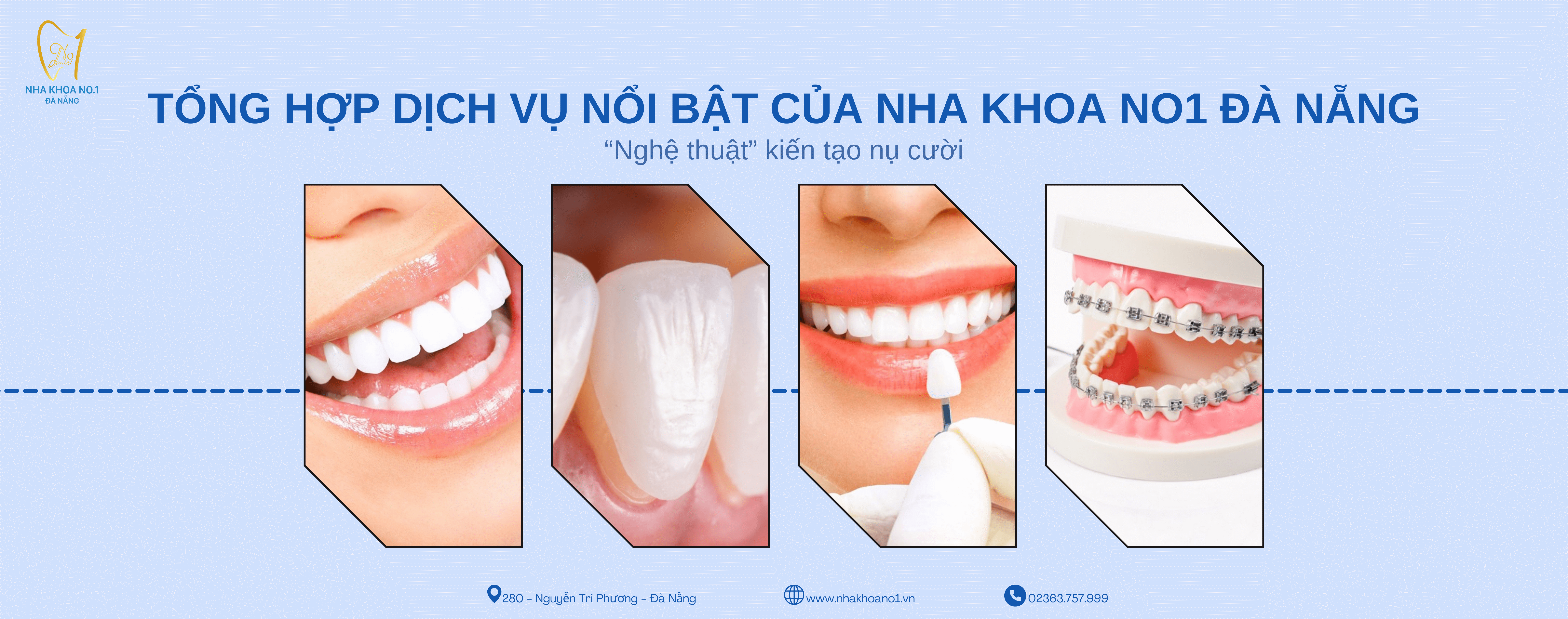 tong-hop-dich-vu-noi-bat-cua-nha-khoa-no1-da-nang