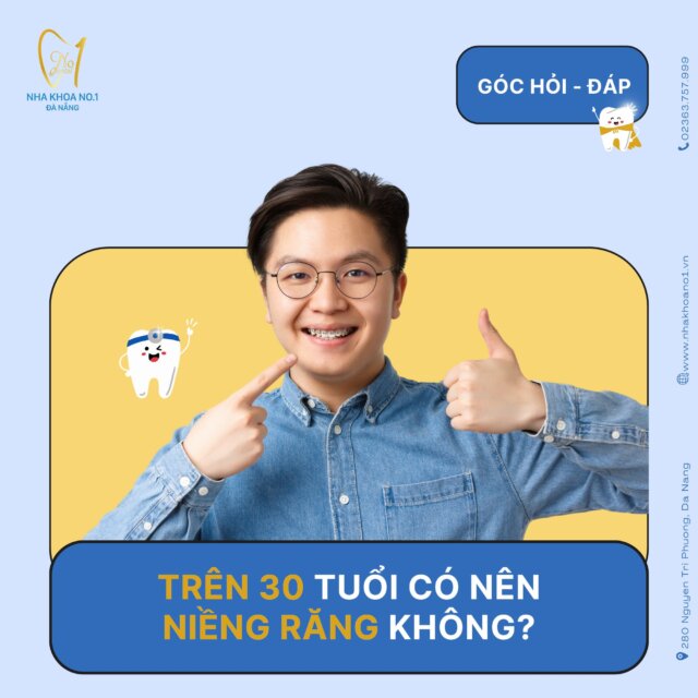 Trên 30 tuổi có nên niềng răng không?