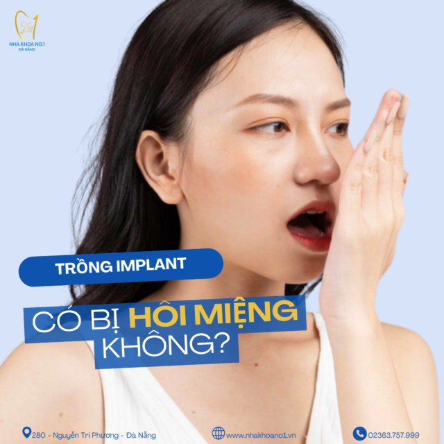 Trồng răng Implant có bị hôi miệng không?