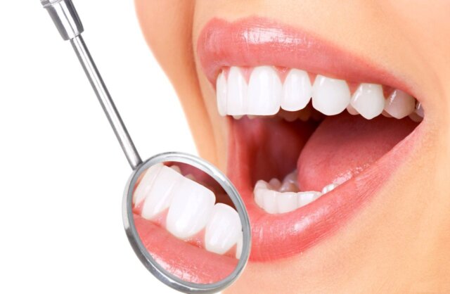 Trường hợp cần thay mới răng sứ