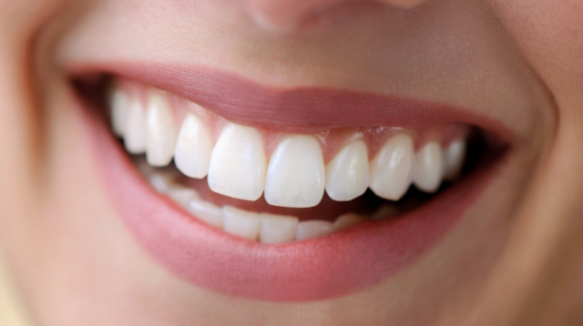 5 Cách sở hữu nụ cười thu hút mọi ánh nhìn