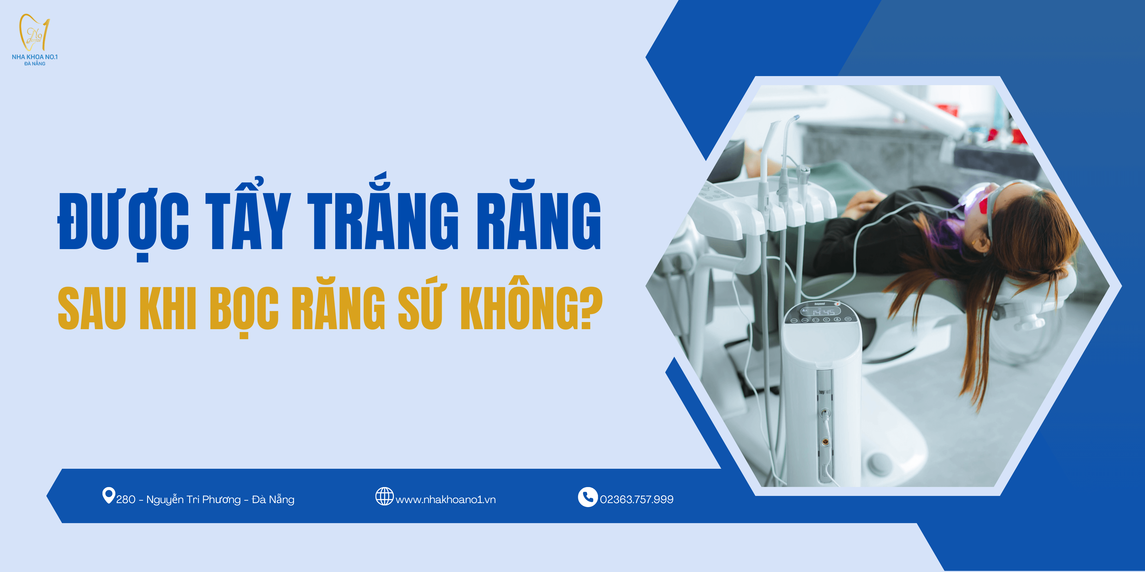 co-the-tay-trang-rang-sau-khi-boc-rang-su-khong
