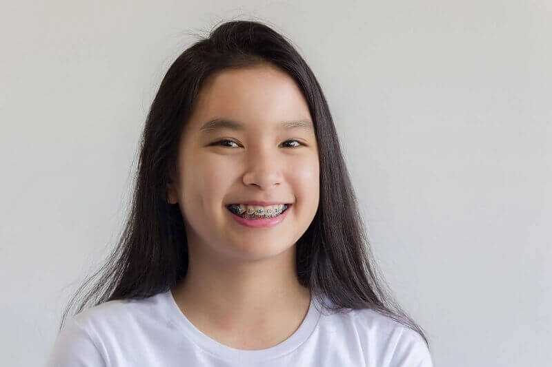 dau-la-giai-doan-xau-nhat-trong-qua-trinh-nieng-rang-4
