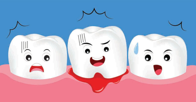 Ê buốt kèm chảy máu chân răng có nguy hiểm không?