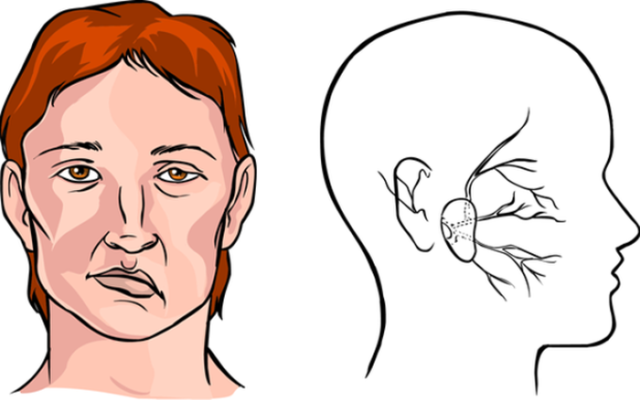 Tình trạng mặt lệch xảy ra do nhiều nguyên nhân khác nhau