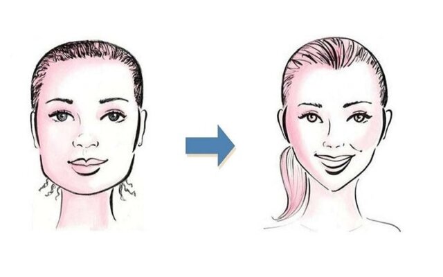 Niềng răng có làm thay đổi gương mặt không?