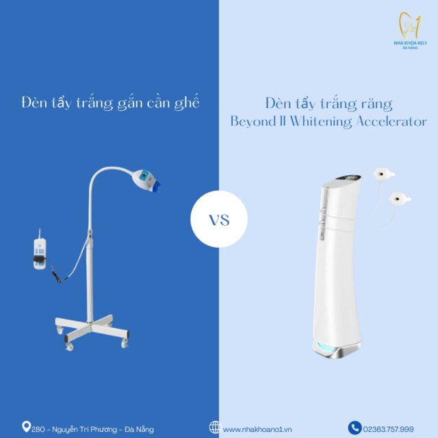 Dịch vụ tẩy trắng răng tại Nha khoa No1 Đà Nẵng