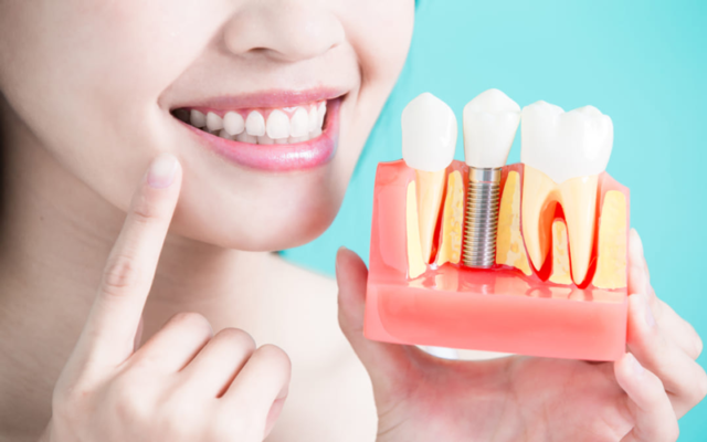 Khắc phục chảy máu khi vệ sinh răng