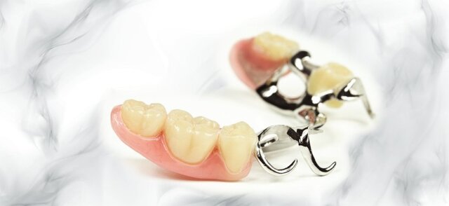 Ưu nhược điểm của hàm khung tháo lắp