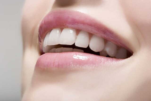Bật mí cách sở hữu răng nanh đẹp
