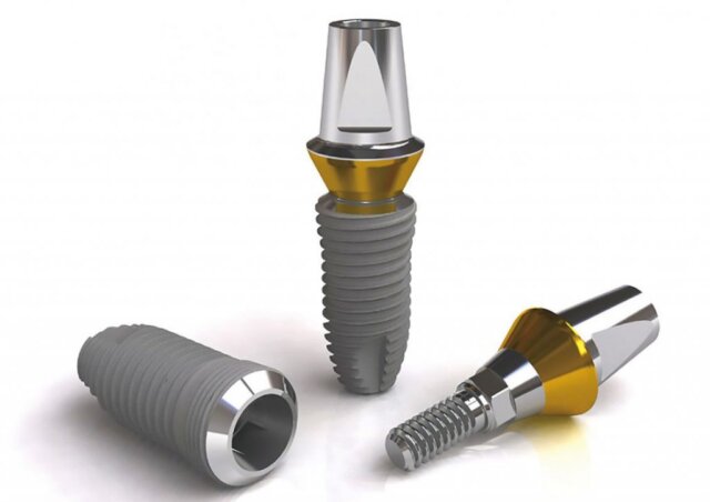 Vì sao Titanium được ưa chuộng trong nha khoa?