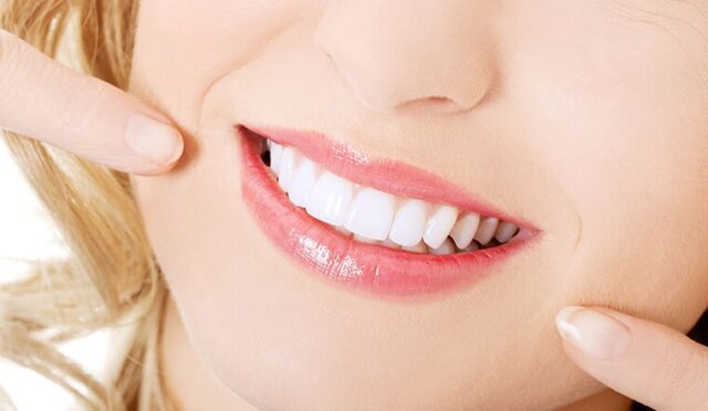 Cách thức chăm sóc răng sứ