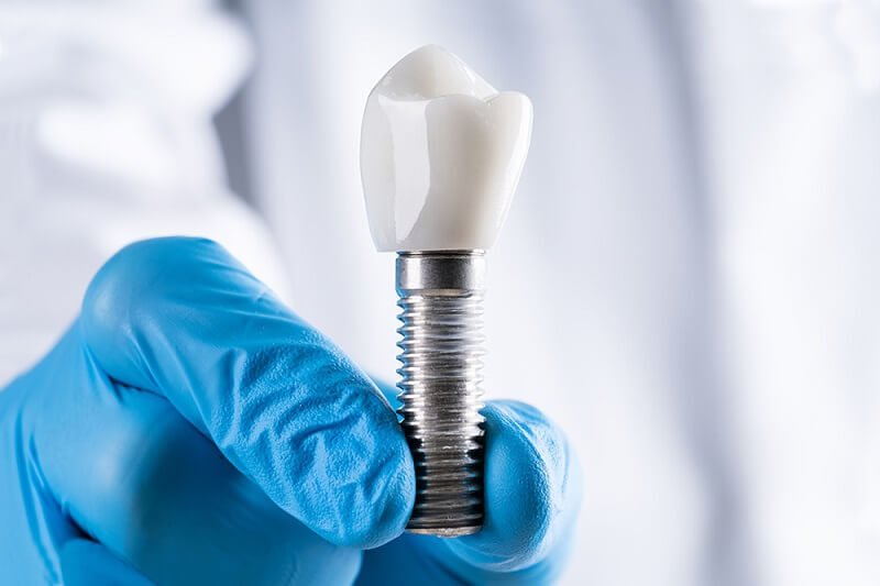 cay-implant-bi-dao-thai-4