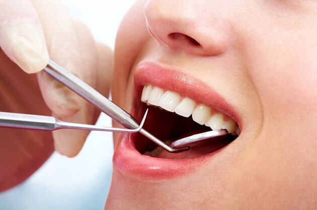 Cách đẩy nhanh tốc độ lành thương sau nhổ răng