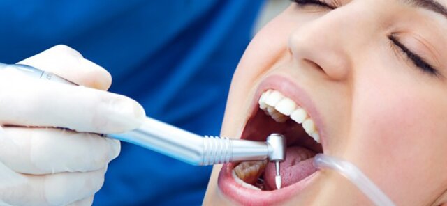 Giải pháp phục hình răng hiệu quả