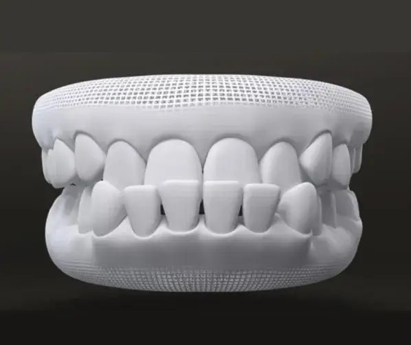 Độ tuổi thích hợp để khắc phục khớp cắn ngược cho trẻ
