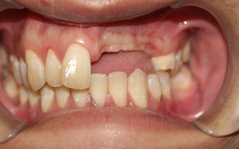 trong-3-rang-lien-tiep-4