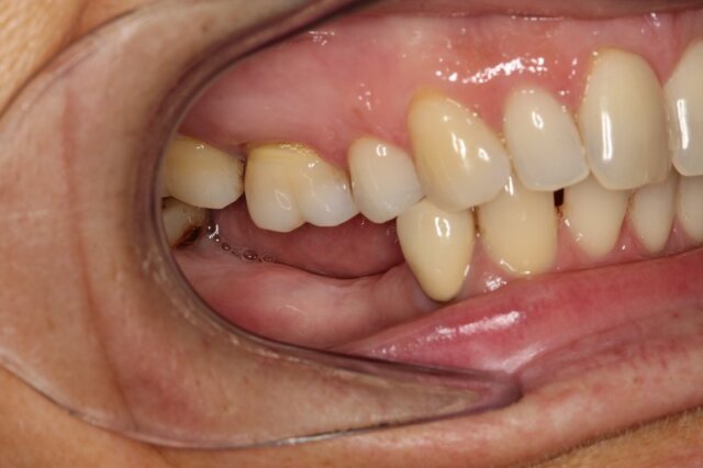 Những yếu tố lựa chọn kỹ thuật thích hợp