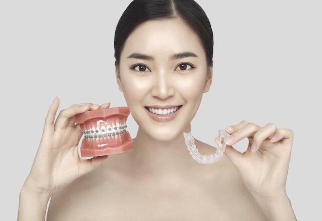 Nước đá có tác động thế nào đến các giải pháp niềng răng?