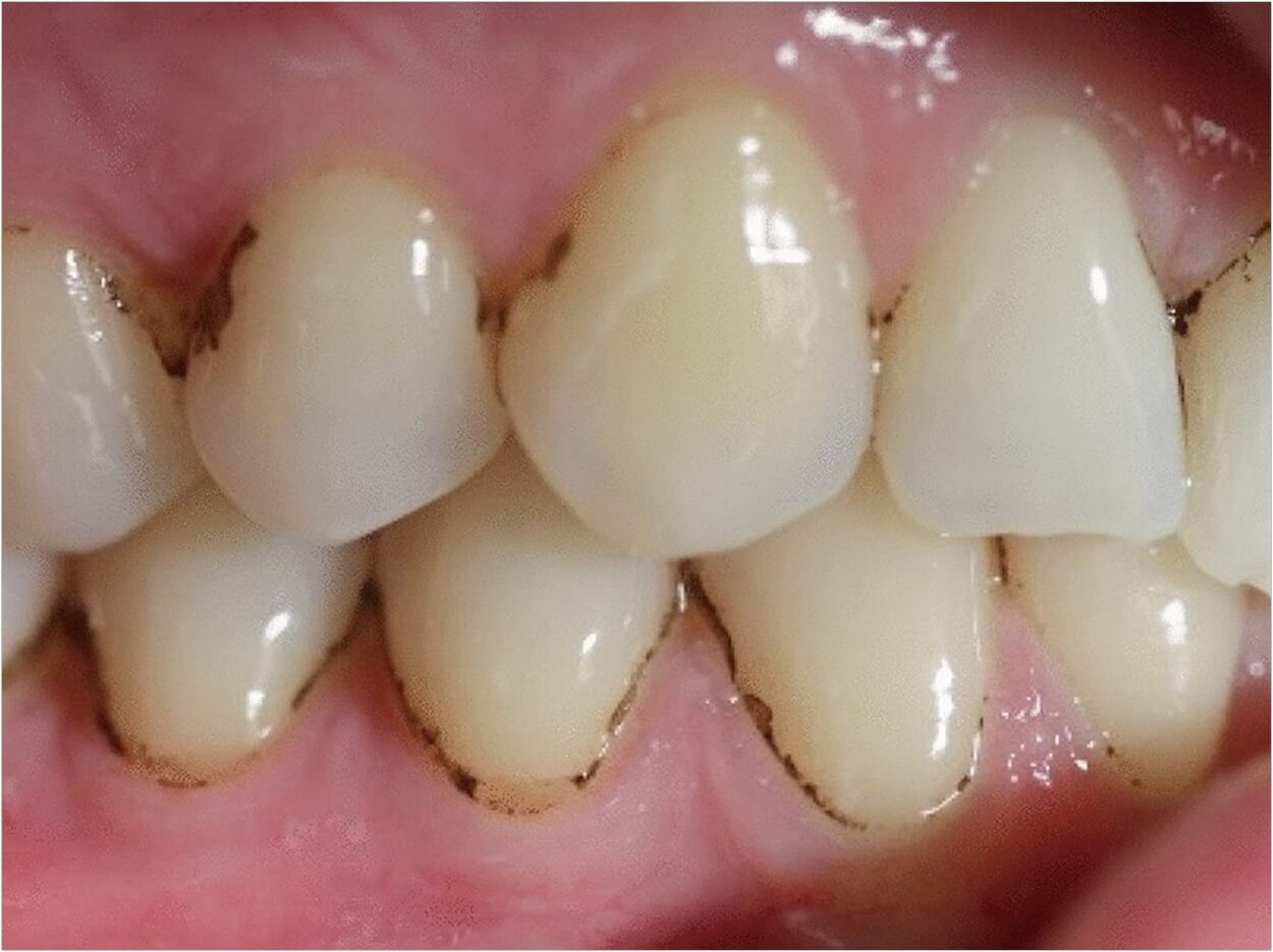 rang-bi-xin-den-1