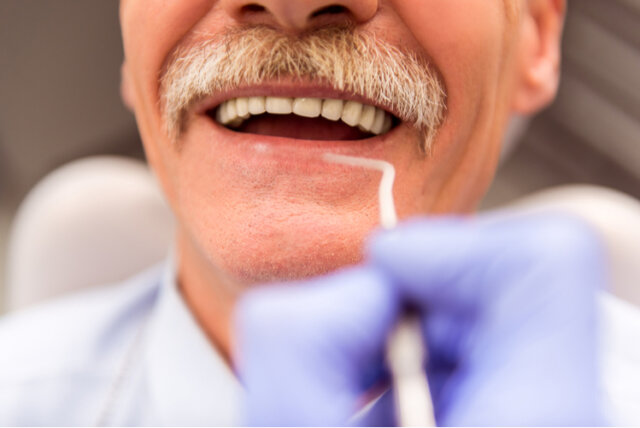 Lưu ý gì khi trồng răng Implant cho người cao tuổi