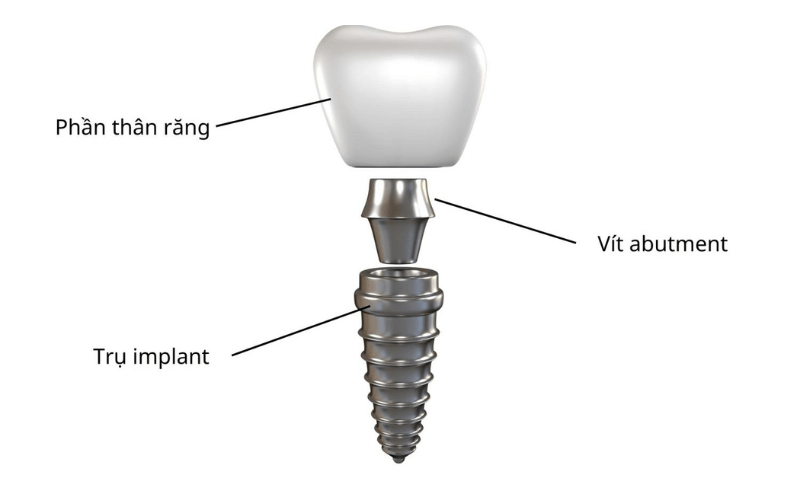 kham-pha-ve-abutment-1