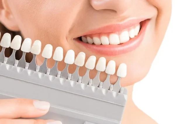 Thẩm mỹ răng sứ mang lại nhiều thay đổi tích cực