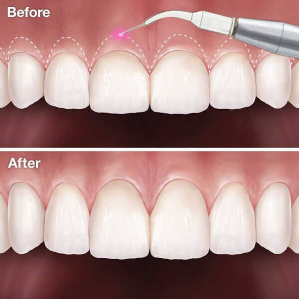 Những ai có thể thực hiện phẫu thuật kéo dài thân răng?