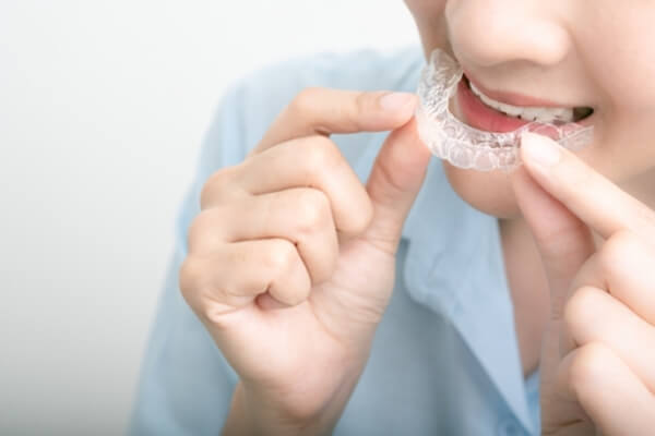 Những lưu ý cần thiết khi niềng răng nhạy cảm