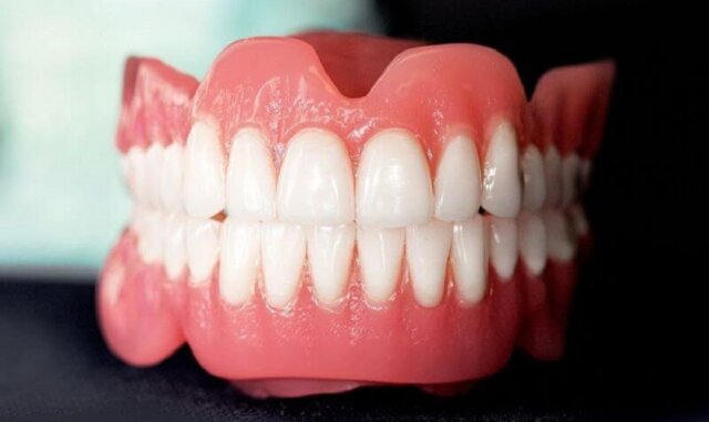 Những ai có thể bọc sứ cả 2 hàm?