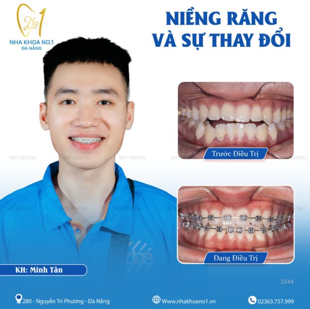 Nha khoa No1 Đà Nẵng: uy tín, tận tâm, chuyên nghiệp