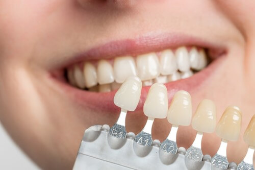 Do đâu mà răng xuất hiện những màu sắc khác nhau?