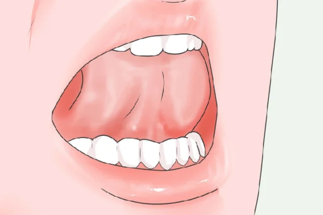 Từ đâu hình thành thói quen đẩy lưỡi