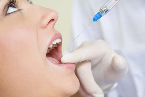 Tìm hiểu về gây tê, gây mê trong nhổ răng khôn