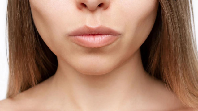 Niềng răng đem lại nhiều lợi ích nổi bật cho người sở hữu gò má cao