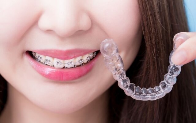 Tại sao nên tuân thủ đeo hàm duy trì sau niềng răng?