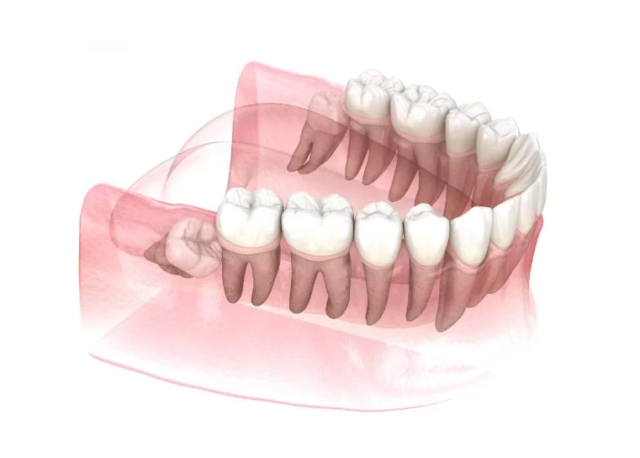 Tình trạng nào được chỉ định và không nên nhổ răng khôn?