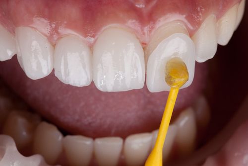 Tìm hiểu về quy trình dán veneer chuẩn