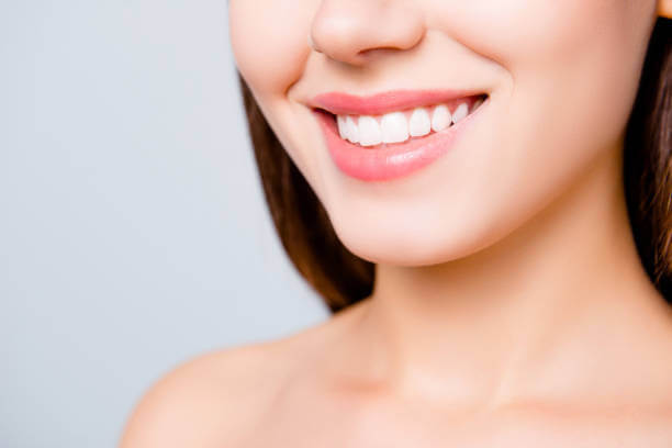 Mọi người định nghĩa thế nào là nụ cười đẹp?