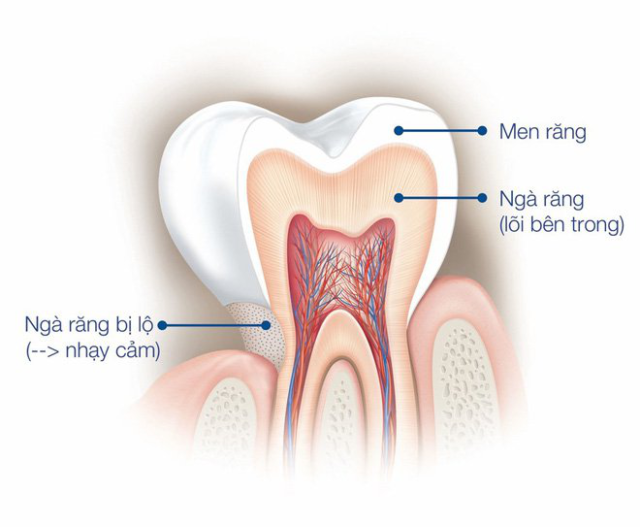 Tìm hiểu về ngà răng và tình trạng sâu răng 